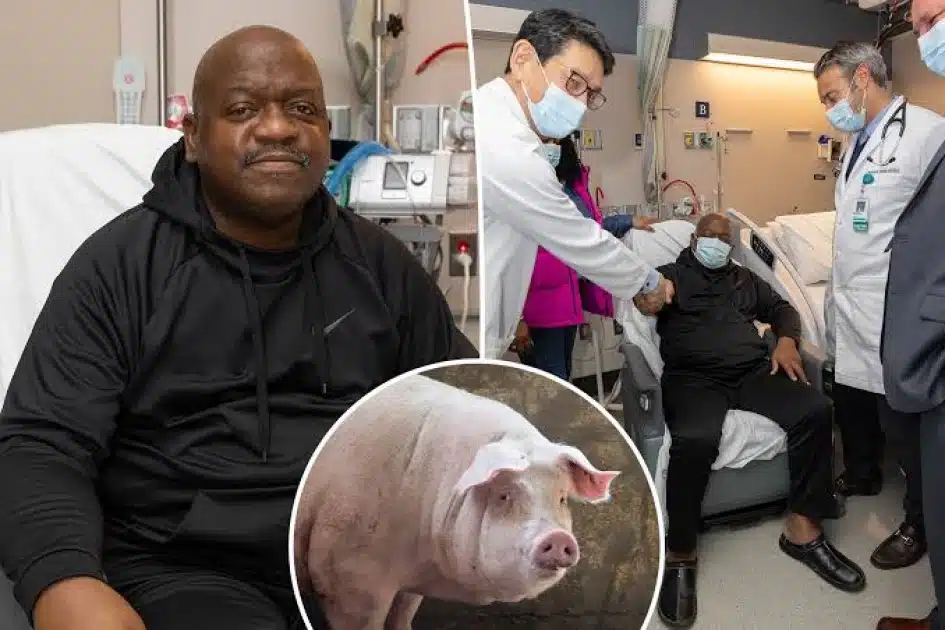 BackBack US man who received first-ever pig kidney transplant dies at 62