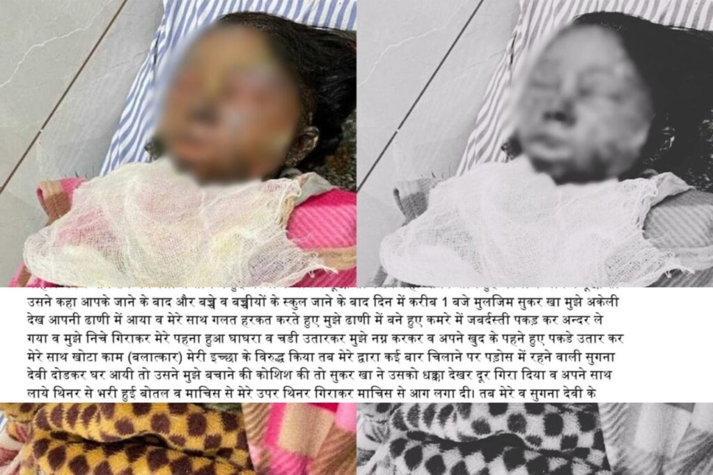 In Rajasthan Shocker, Deaf-Mute Girl, 11, Dies After Being Set On Fire